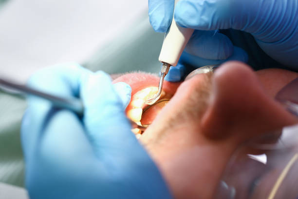 Best Urgent Tooth Repair  in Galliano, LA