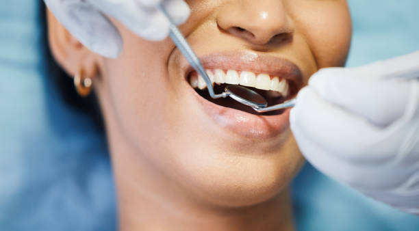 Best Cracked Tooth Emergency Dentist  in Galliano, LA